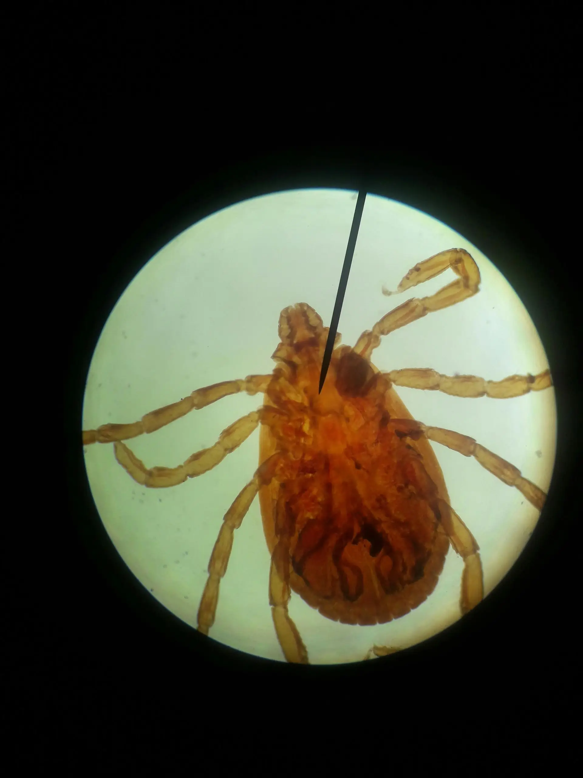 Tick magnified under a microscope